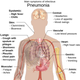 Symptoms of pneumonia. (Credit: Mikael Häggström)